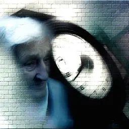 what is Alzheimer’s disease