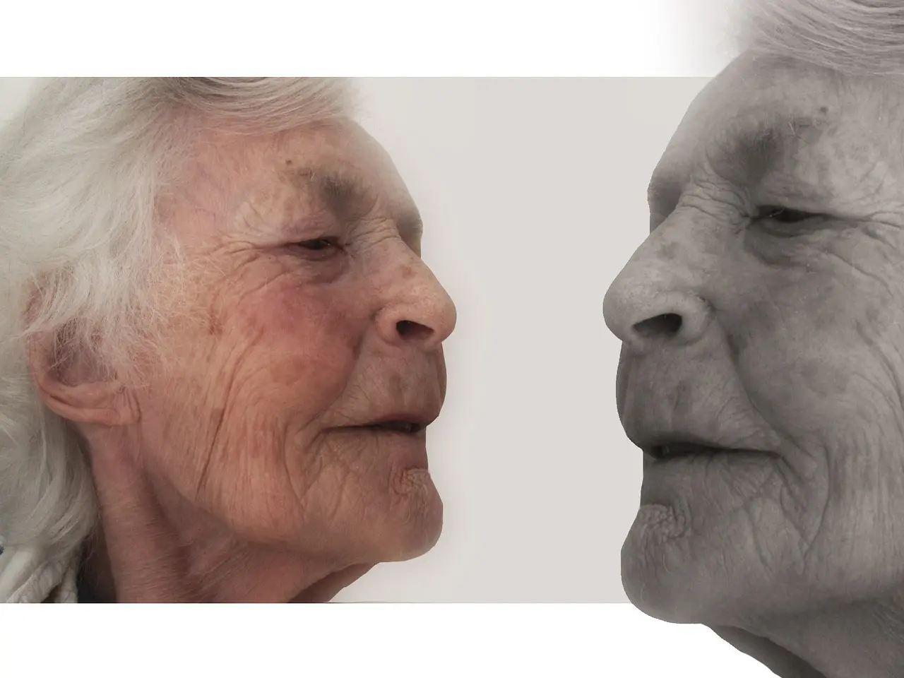 Dementia care
