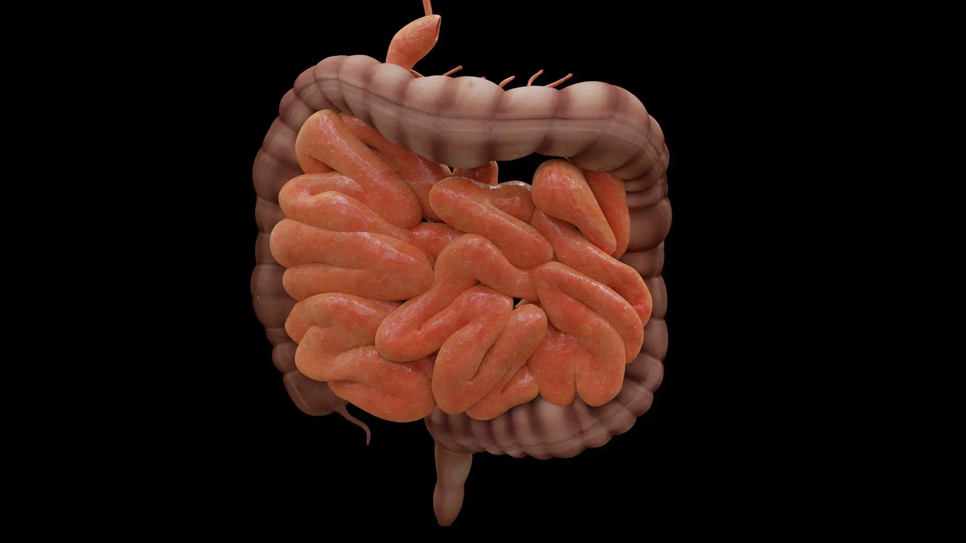 Bowel Problems in the Elderly