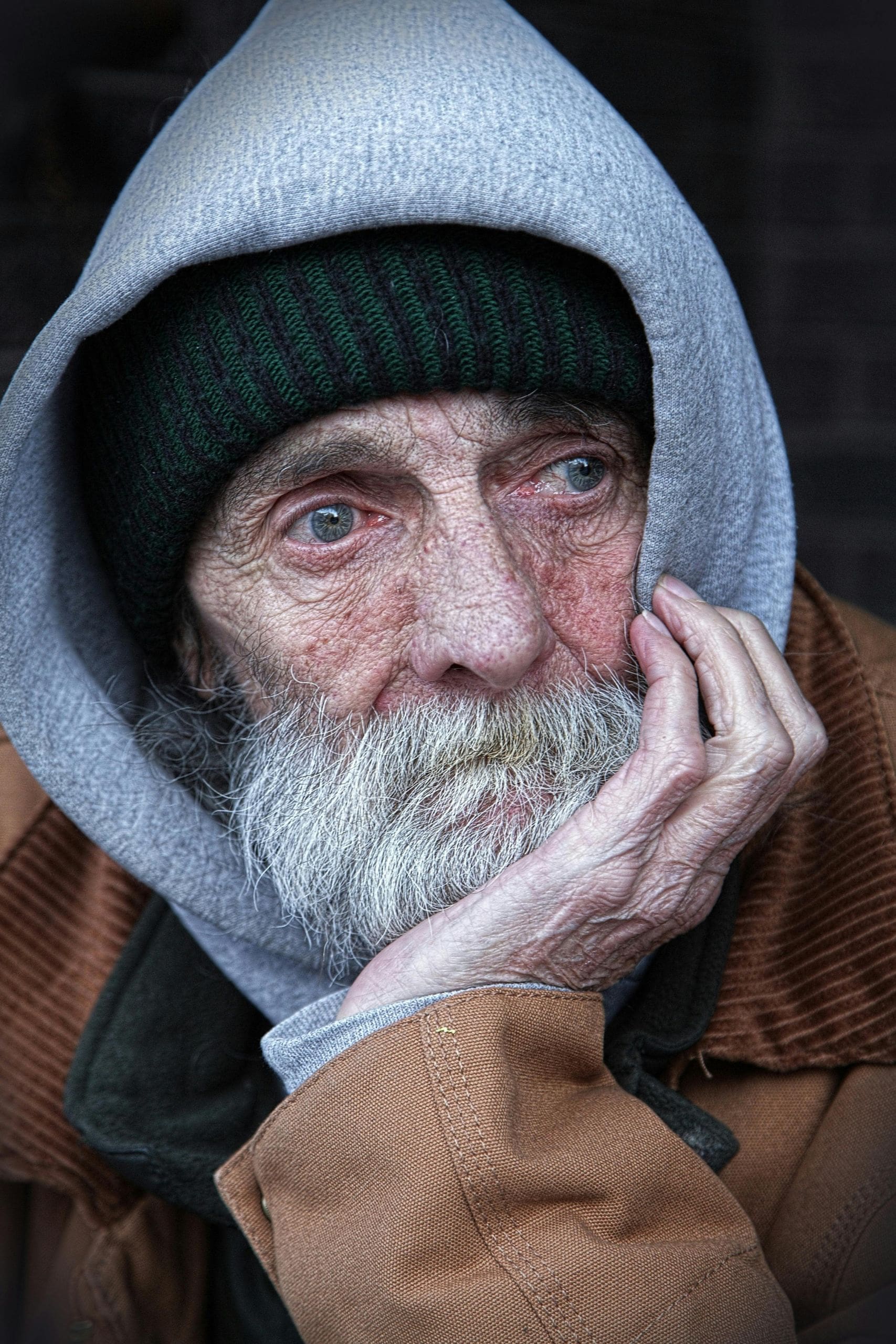 Treatment and Management of Mixed Dementia